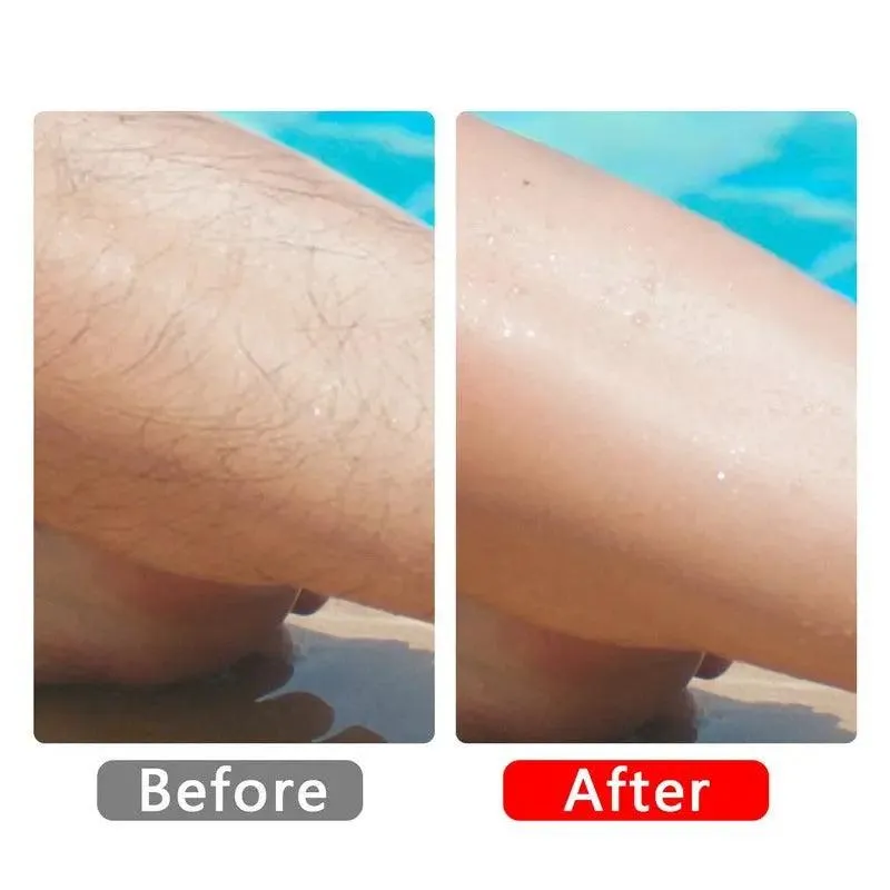 Easy Cleaning Epilator